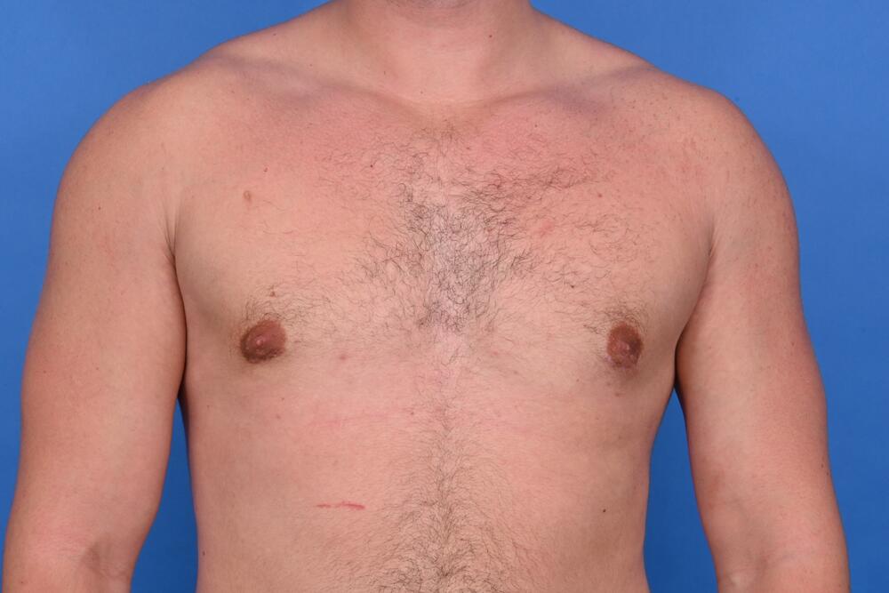 Patient Before & After Image