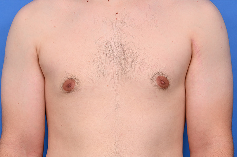 Patient Before & After Image