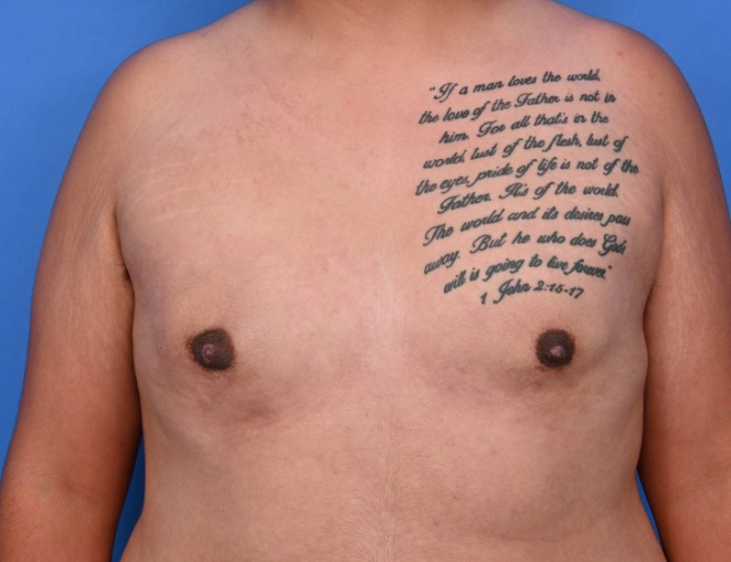 Patient Before & After Image