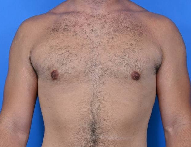 Patient Before & After Image