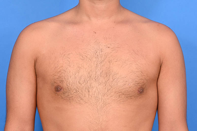 Patient Before & After Image