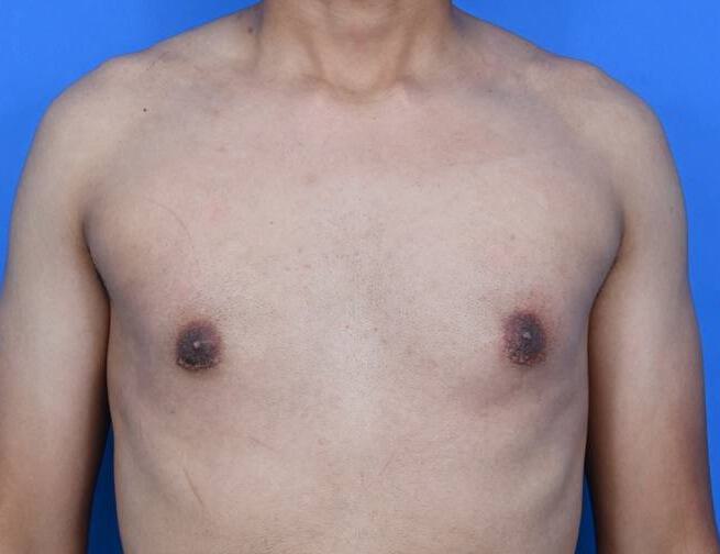 Patient Before & After Image