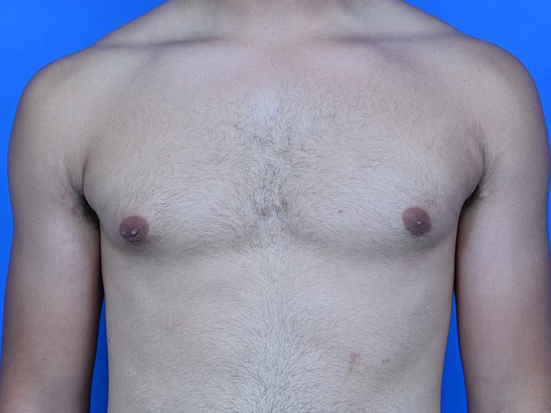 Patient Before & After Image