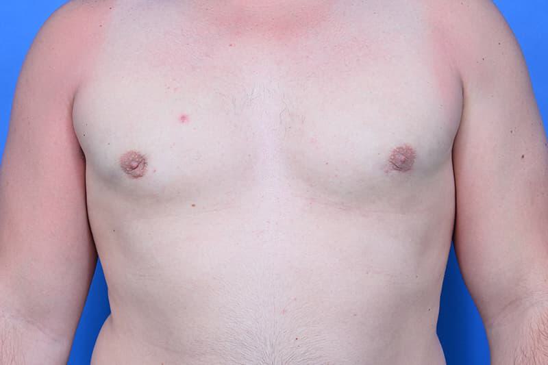 Patient Before & After Image