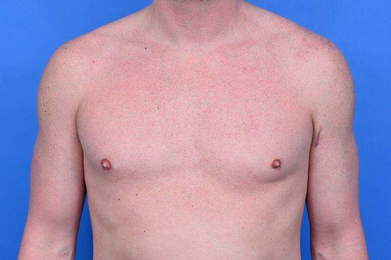 Patient Before & After Image