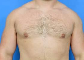 Patient Before & After Image