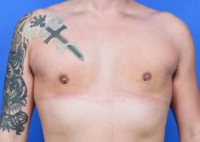 Patient Before & After Image