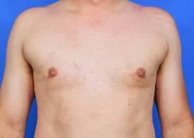 Patient Before & After Image