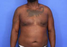 Patient Before & After Image