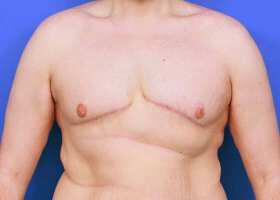 Patient Before & After Image