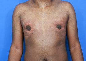 Patient Before & After Image