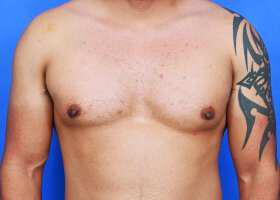 Patient Before & After Image