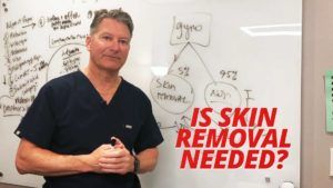 When Is Skin Removal Needed video thumbnail