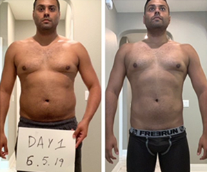 Weight loss and Gynecomastia