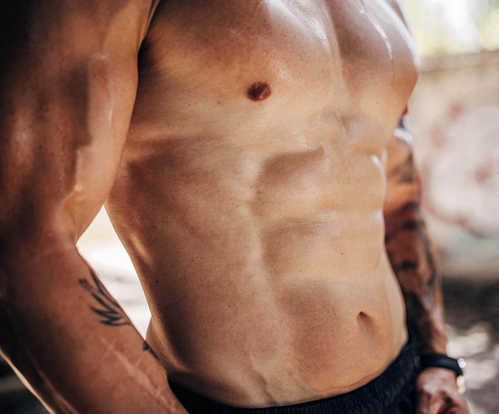 What Is Gynecomastia? Understanding This Common but Overlooked Condition in Men